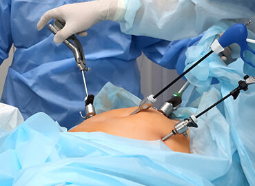 laparoscopic-surgery